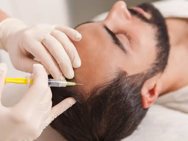 GFC Treatment for Hair Loss: How Growth Factor Concentrate Supports Hair Regrowth